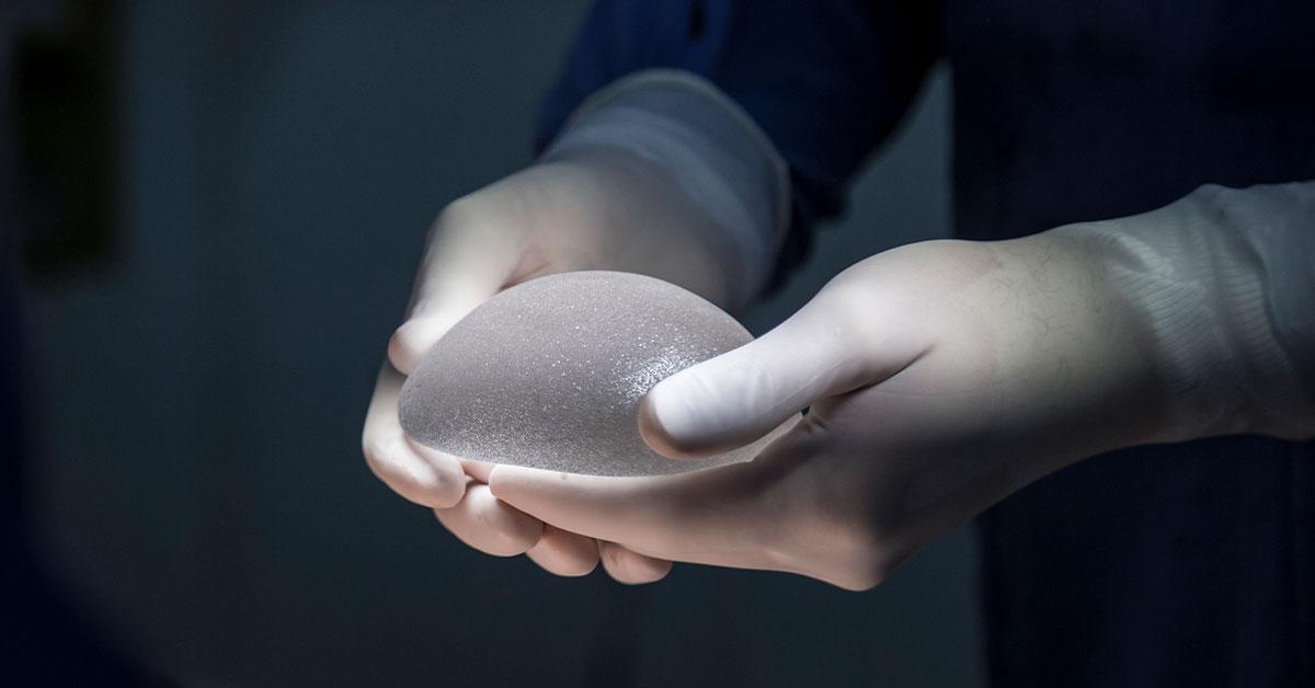 Implantes mamários e câncer raro: alerta global após mais de 100 casos confirmados na Espanha