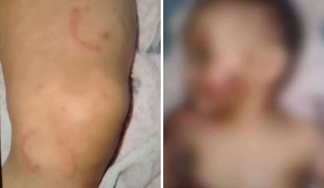 Bebê de 7 meses é resgatado com marcas de mordidas em Vila Velha; mãe e padrasto são presos