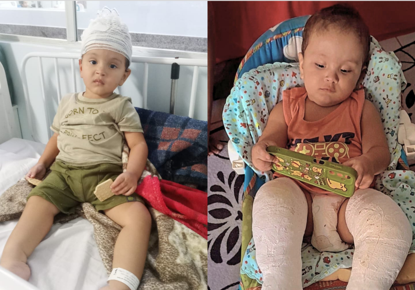 Família de Cachoeiro mobiliza campanha para ajudar Emanuel, de 2 anos