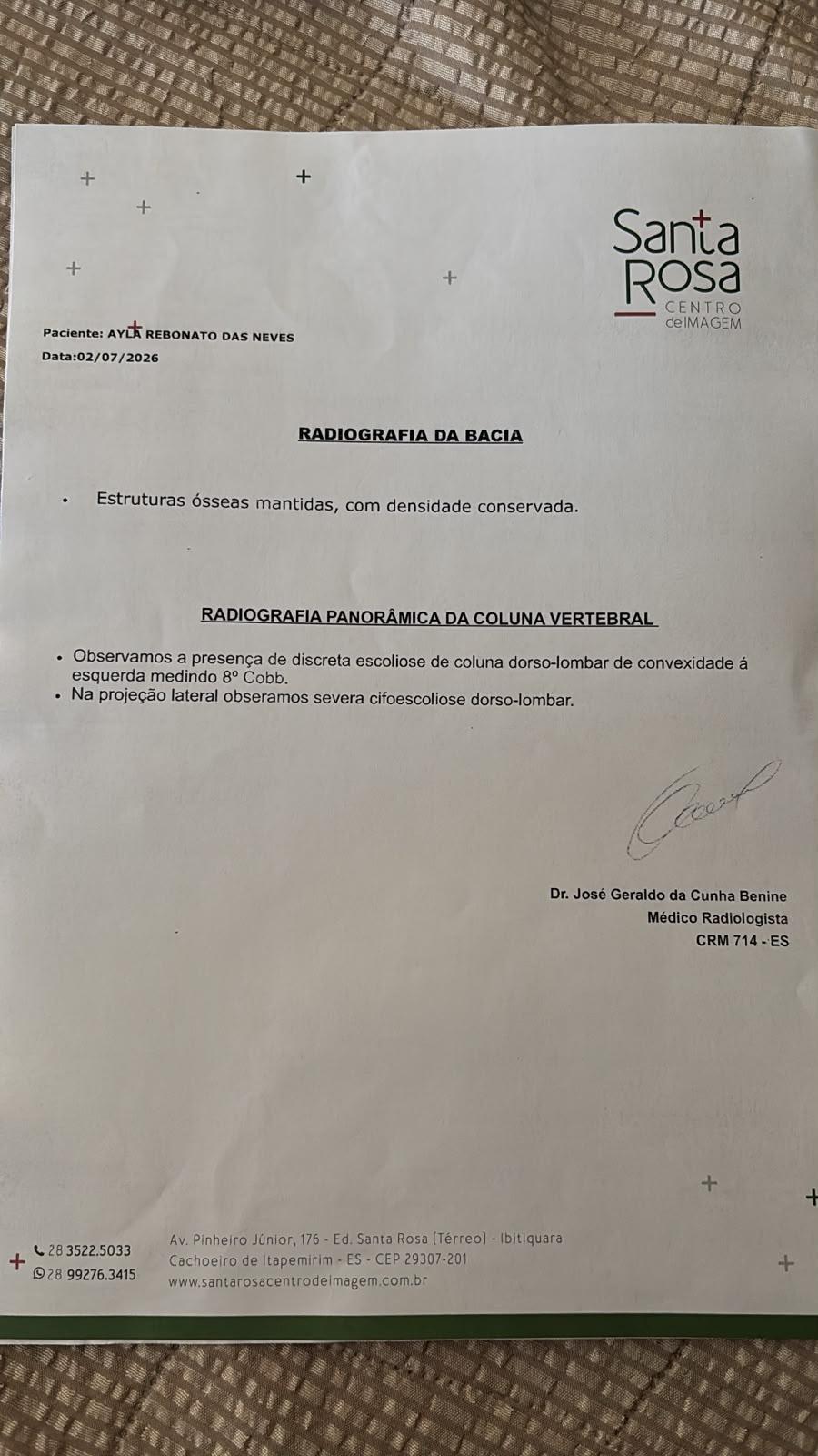 Exame radiológico realizado em julho de 2026 aponta alterações na coluna, incluindo escoliose e cifoescoliose dorso-lombar, reforçando a necessidade do tratamento intensivo indicado para a pequena Ayla.