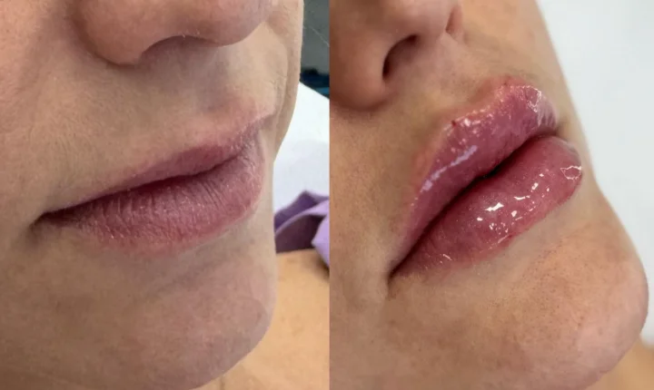Estética Thamires Ignez