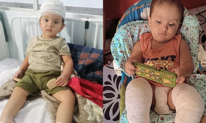 Família de Cachoeiro mobiliza campanha para ajudar Emanuel, de 2 anos